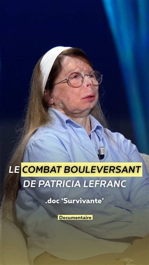 Survivante : Patricia Lefranc, reconstruire après une attaque au vitriol