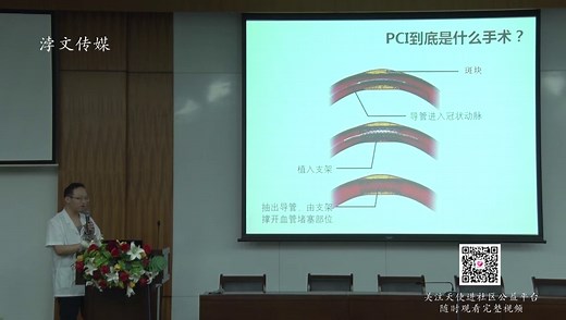 PCI到底是什么手术？