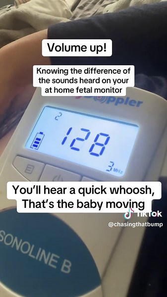 Understanding Fetal Heart Sounds for Moms-to-be