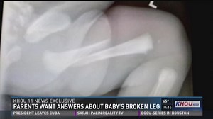 Parents want answers about baby's broken leg