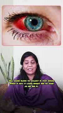 🚨 Woke up with a blood-red eye? STOP before you panic!