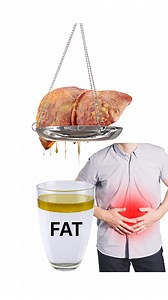 4.8M views · 97K reactions | Fatty liver symptoms | Ate Dok | Facebook