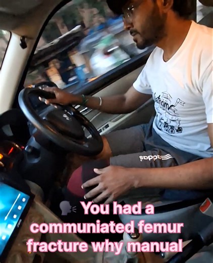 Driving manual car after communiated distal femur fracture #recovery #femurfracture #cardriving