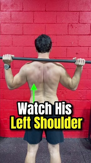Michael had been dealing with extreme shoulder pain for MONTHS that 20 doctors and 4 physical therapists had not been able to find a fix for. Today I want to show you parts of our evaluation & treatment that was able to lay out a clear path for his rehabilitation. . Update: since this day Michael has kept up the program and has seen great results! The exercises I show aren’t a magic fix but with proper testing & exercise prescription we can find a clear path to help many injuries with time & con