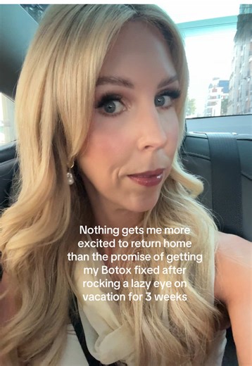 Importance of Timing for Botox Treatments Before Events