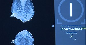 Riverside Health System to use artificial intelligence in breast cancer screenings