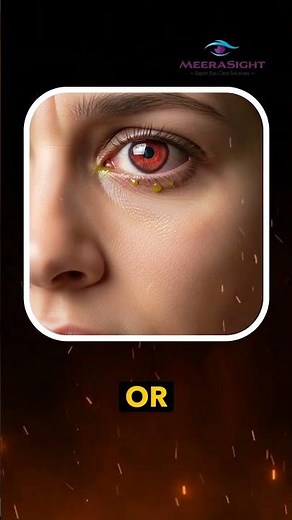 Do you wear contact lenses?BEWARE! These common mistakes can permanently DAMAGE your eyes |Dr. Sonia