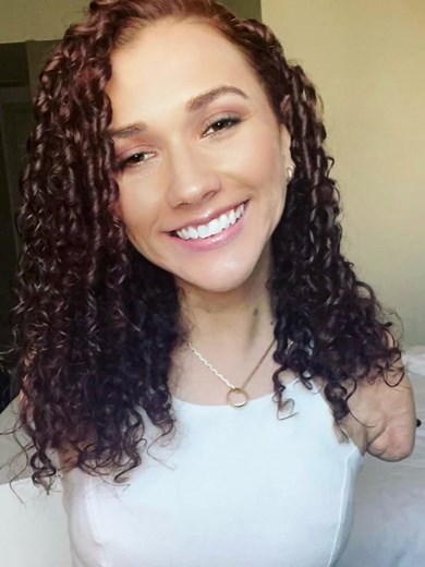 #amputeegirl #armless #armlessgirl #amputee #armlessbandit