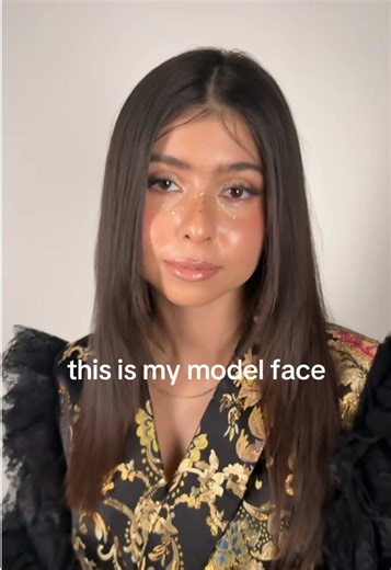 Modeling with Acne: Embracing Natural Beauty