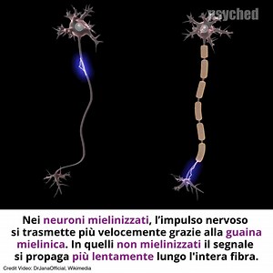 LA TRASMISSIONE DEL SEGNALE NERVOSO Il neurone è l'unità funzionale del tessuto nervoso. Si tratta di cellule altamente specializzate costituite da una parte centrale chiamata soma, da esso nascono due tipi di prolungamenti: i dendriti e l'assone. I dendriti ricevono i segnali elettrici da parte dei neuroni confinanti e sono in grado di trasmettere tale segnale al soma. L’assone è un prolungamento lungo e sottile del neurone, attraverso cui si propagano i potenziali d'azione, ovvero un evento ca
