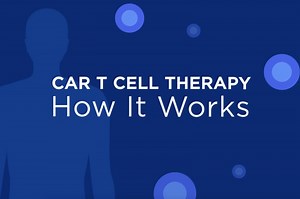 Video: CAR T Cell Therapy: What It Is and How It Works