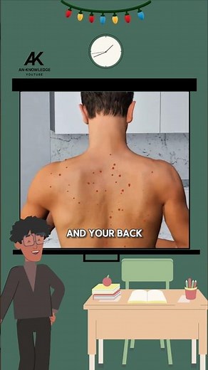 Be careful with back acne #facts #short