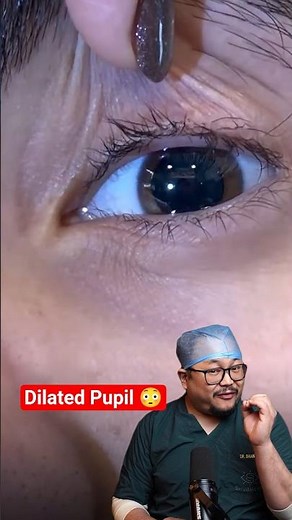 Dilated Pupils Explained | Why Doctors Dilate Eyes