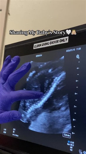 #itslyset #angelbaby #grieving #infantlossawareness #stillborn
