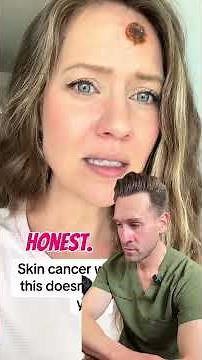 When ‘too young’ for skin cancer isn’t true