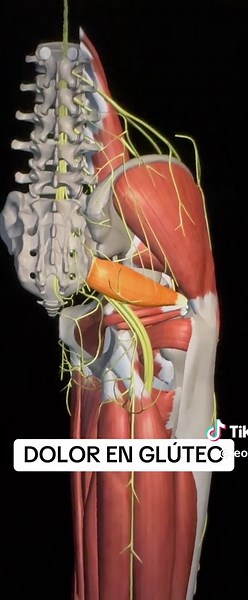 Síndrome del Piramidal: Causas y Tratamientos del Dolor