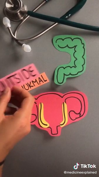 Understanding Endometriosis: Explained by Science