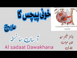 khooni pechis ka asaan ilaj, Desentery treatment