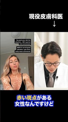 Red Spots on the Body!! What Is This Disease? 【Ask Dr. Hanabusa】