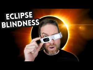 How To Watch A Solar Eclipse Safely - Don't Go Blind!