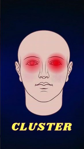 What Your Headache is Telling You? 🧠