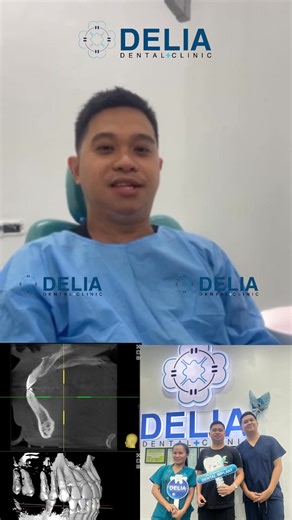 3 DENTAL IMPLANTS AT ONCE – "IT DIDN'T HURT AS I EXPECTED!" Mr. Joseph – a client who has just completed a procedure for 3 dental implants at Delia Dental Clinic – was completely amazed by his experience: ✅ 3 Implants in One Visit: Saves time and ensures a faster recovery. ✅ Precision Technique: Using premium implant posts for life-long durability. ✅ Completely Pain-Free: "After the surgery, I didn't experience any pain at all; everything was very smooth," shared Mr. Joseph. At Delia, we don't j