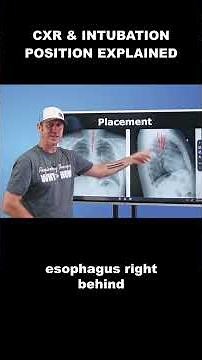 Respiratory Therapy - Chest X-ray & Intubation Position vs Placement Explained