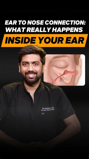 Dr. Sathya JD on Instagram: "Ear to nose connection : What really happens inside your ear? . . . . . [Eustachian Tube Dysfunction, Tympanic Membrane Perforation, Middle Ear Anatomy, Otitis Media Complications, Hearing Loss Prevention]"