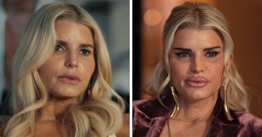 Jessica Simpson’s Botched Plastic Surgery For ‘All’s Fair’ Role Stuns Fans In Acting Return