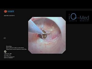 HAWK - URETEROSCOP FLEXIBIL DIGITAL