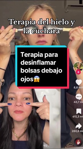 Terapia del hielo y la cuchara para desinflamar bolsas debajo de los ojos