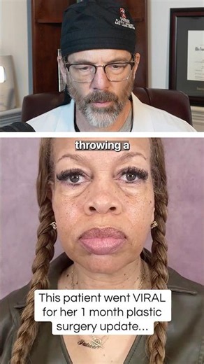 This Transformation is TOO GOOD 😱 Surgeon Reacts