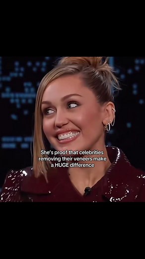 Miley Cyrus: The Impact of Removing Veneers