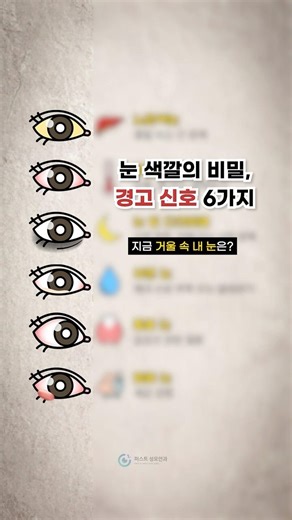 지금 거울 속 내 눈 색깔은? (늦기전에 확인!)