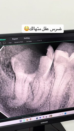 #س #مجمع #الامجاد #الطبي#صحتك #اسنان #عروضات #لايكي #مدينتي #الهجره#جديد #مشاهدات @Alamjad_United