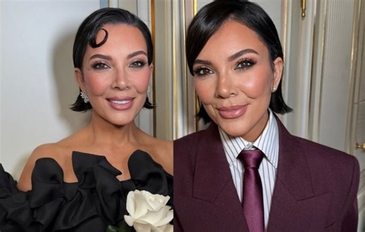 C’est quoi le mini-lifting ? Une technique moins invasive (mais aussi moins spectaculaire qu’un vrai lifting)