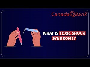Toxic Shock Syndrome Explained | Causes, Diagnosis & Management | CanadaQBank