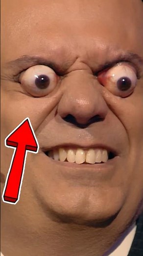 Eyes Popping Out #rareconditions