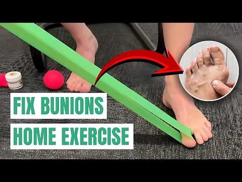 Bunion Fix: Home Exercise Routine