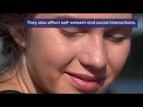 Advanced Smile Transformation with SureSmile