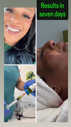 Amazing Skin Care Med Spa | A dermaplane facial combined with BioRePeel offers a powerful skin rejuvenation experience. Dermaplaning, which involves removing dead skin... | Instagram