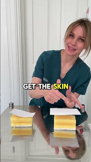 How does Profhilo work?