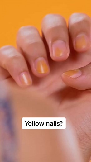 How to Remove Yellow Stains from Your Nails with Baking Soda