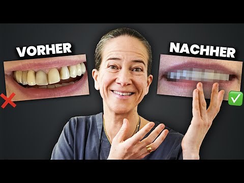Schöne Zähne: vom Durchschnitt zur Perfektion: Vorher-Nachher-Bilder