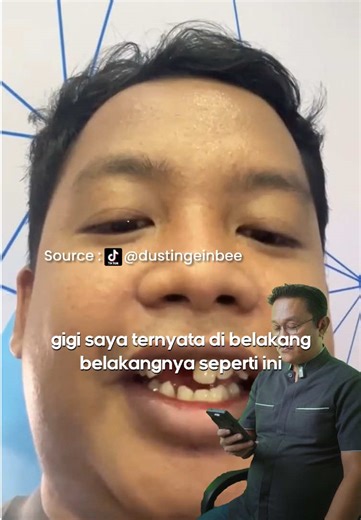 Implan Gigi Murah Surabaya on TikTok
