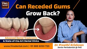 https://youtu.be/zB5L_oK0iUE Gum recession is a common dental issue affecting millions of people worldwide. If you’ve noticed your teeth looking longer or you’re experiencing sensitivity near the gum line, you might be dealing with receding gums. But the big question is: Can gums that have receded actually grow back? In this video, our dental experts explain everything about gum recession, its causes, symptoms, and most importantly—treatment options. We bust the myths and share scientifically ba