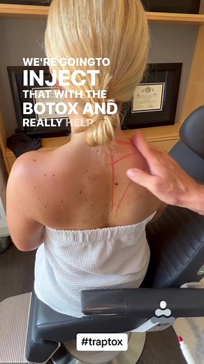 Understanding TrapTox: Botox for Posture and Neck Relaxation