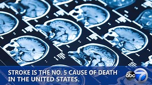 Stroke: How to spot the warning signs, symptoms