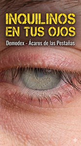 👁️ ¿PICOR MATUTINO? 🕷️ No es alergia. Son los Demodex. Pequeños arácnidos que viven en tus poros y salen de noche a reproducirse en tu cara. Si no te lavas, causan Blefaritis y tus pestañas se caen. 📉 Lávate antes de dormir o acepta que caminen por ahí esta noche. 👇 #CienciaEnSegundos #Salud #Ojos #Acaros #Demodex #Higiene | CSS Reacciones