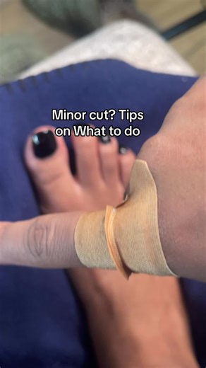 Easy tutorial on how to treat minor cuts, hope this helps🫶🏽 #healthtips #healthadvice #firstaid #cut #fingercut